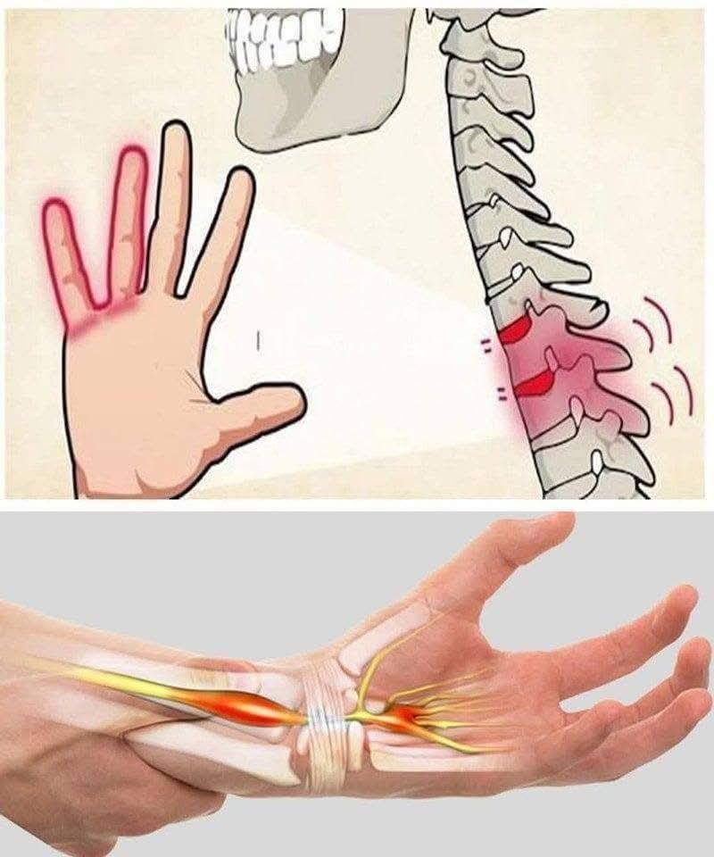 Hand Numbness: Is It Normal or a Symptom of a Problem?