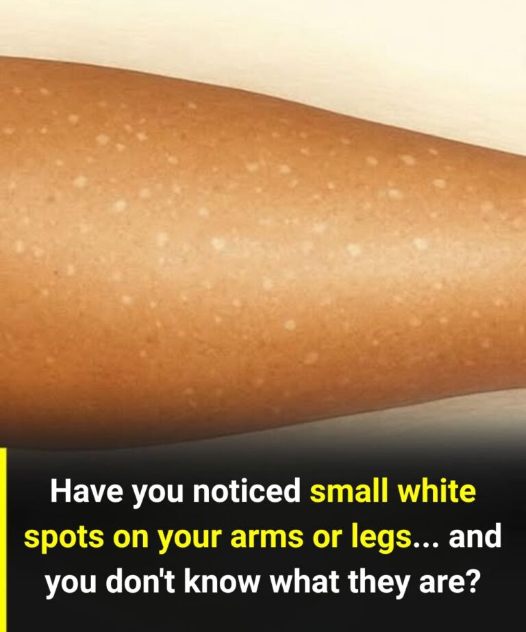 White Spots on Skin: Which Vitamin Deficiencies Could Be the Cause?