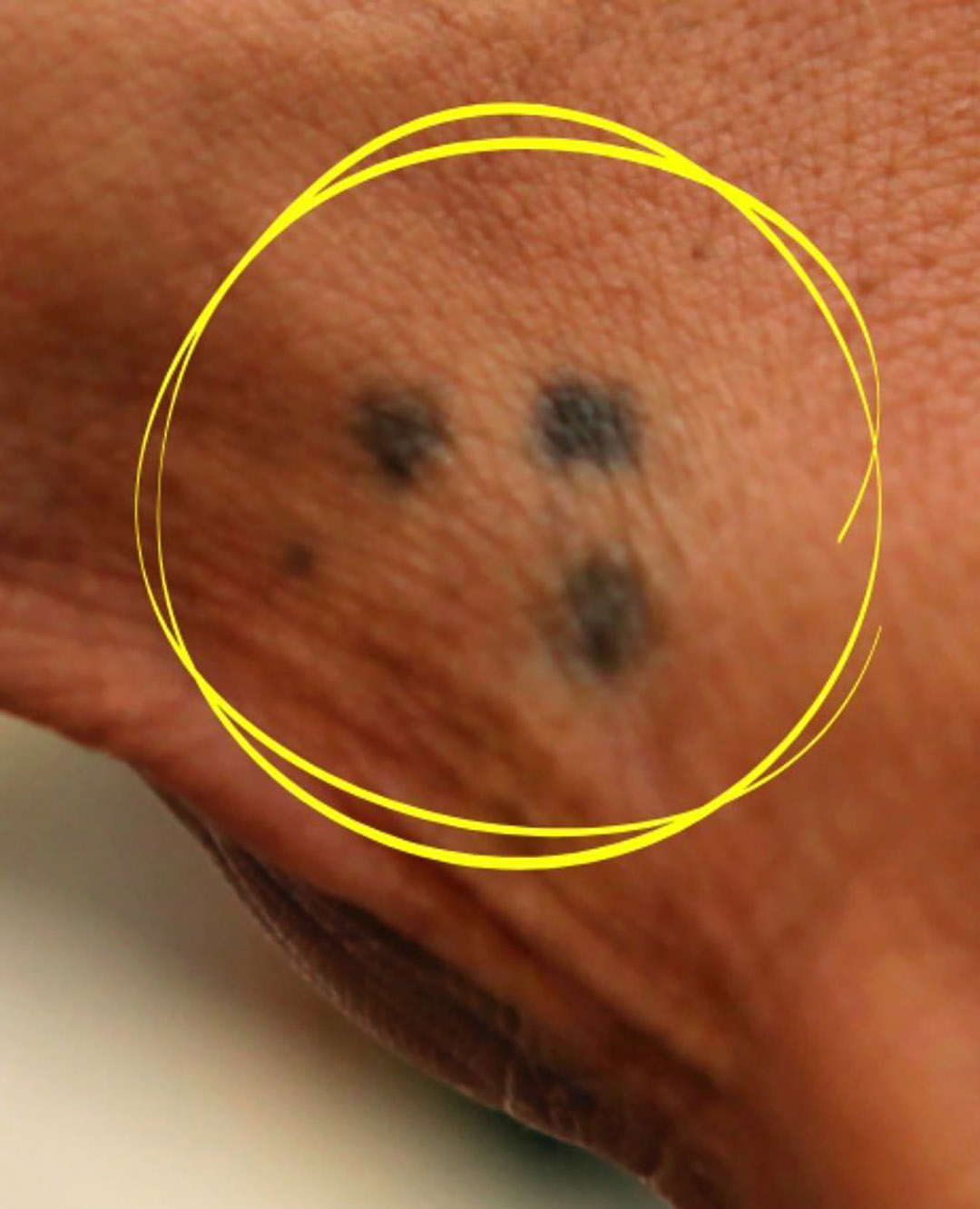 The mystery of the three tattooed dots: an emblem with multiple interpretations