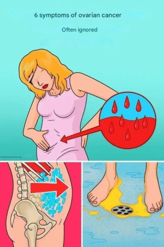6 Often Missed Symptoms of Ovarian Cancer
