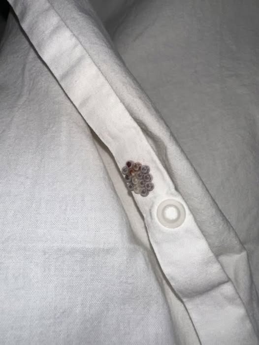 Tiny Eggs on Your Sheets? Here’s What You’re Actually Dealing With