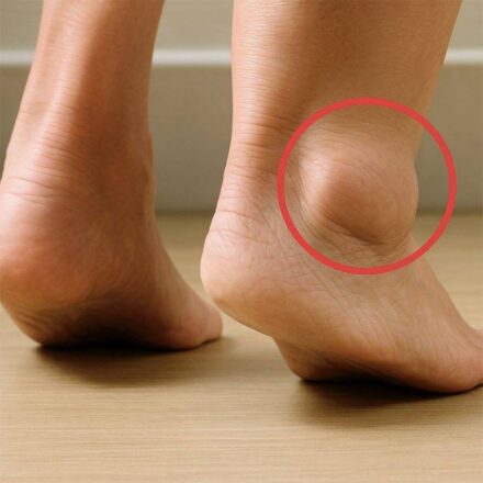 swollen legs: what are the symptoms and treatments