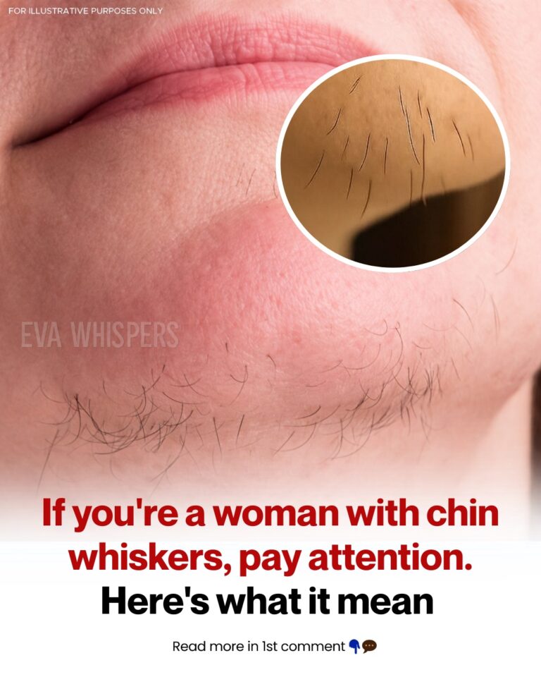 If You’re A Woman With Chin Whiskers, Here’s What It Means