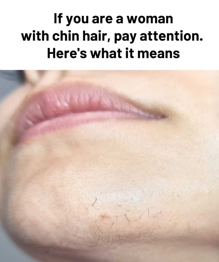 Understanding Coarse Facial Hair Growth in Women: Clinical Insights and When to Seek Evaluation