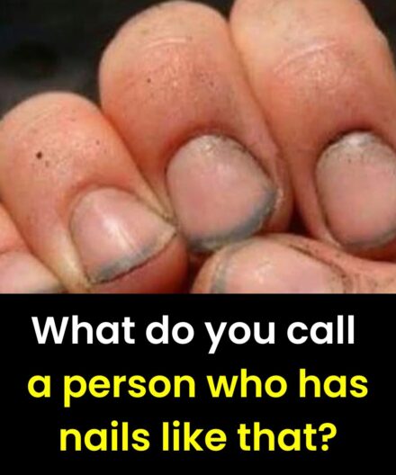 What do you call a person who has nails like that ??🤔🤔??