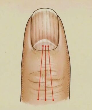 What to Eat to Reduce Nail Ridges: A Nutrition Guide for Healthier, Stronger Nails