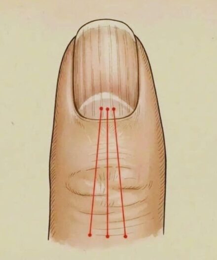 What to Eat to Reduce Nail Ridges: A Nutrition Guide for Healthier, Stronger Nails