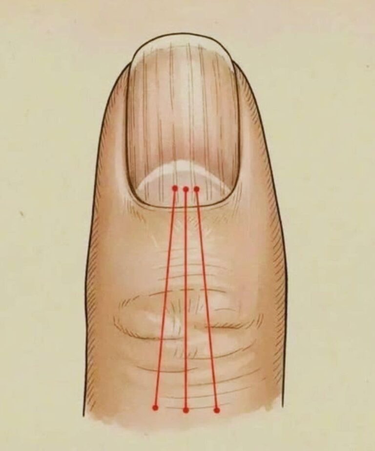 What to Eat to Reduce Nail Ridges: A Nutrition Guide for Healthier, Stronger Nails