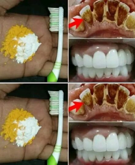 Home Teeth Whitening: Get Whiter Teeth in Just 2 Minutes!