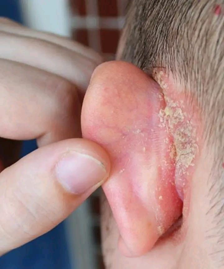 Caring for Your Child’s Ear: A Parent-Friendly Guide to Understanding Skin Changes
