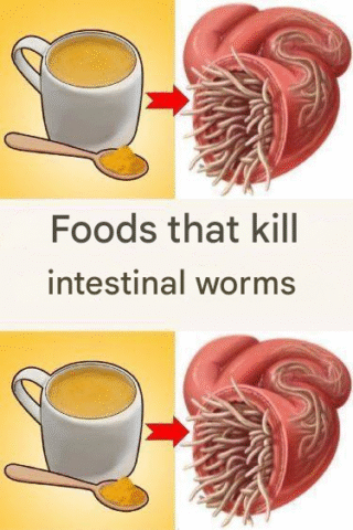 7 Foods That Kill Intestinal Worms