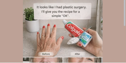 “It Looks Like I Had Plastic Surgery”: The Viral Home Remedy People Are Using to Improve the Appearance of Wrinkles and Dark Spots on Hands and Arms