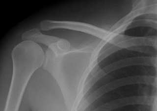 This “poison” damages your bones – and you drink it every day!