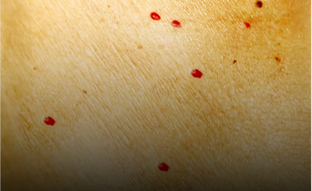 If you notice these red spots on your skin, here’s what they mean.