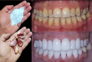 How to whiten your teeth in 2 minutes?