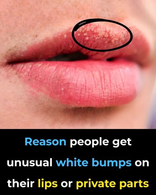 Reason behind strange white bumps found on your private parts