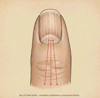 Silent warnings in fingernails