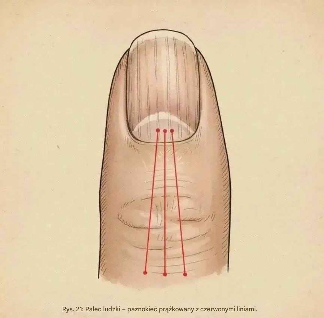 Silent warnings in fingernails