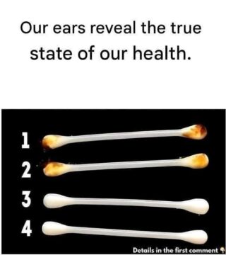 Our ears reveal the true state of our health