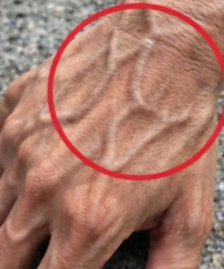 If your veins are visible in your hand, it is a signal of …