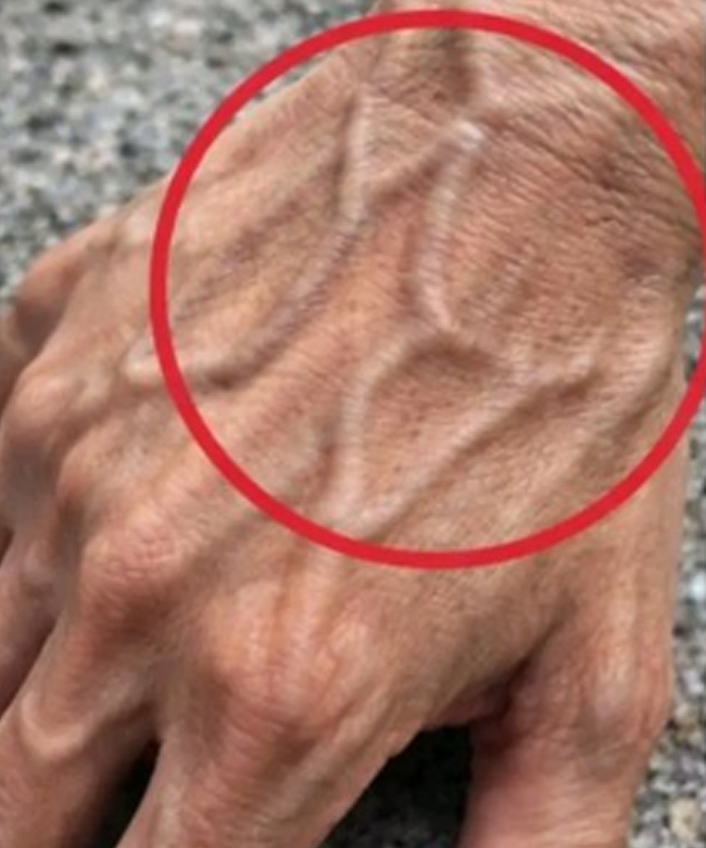 If your veins are visible in your hand, it is a signal of …