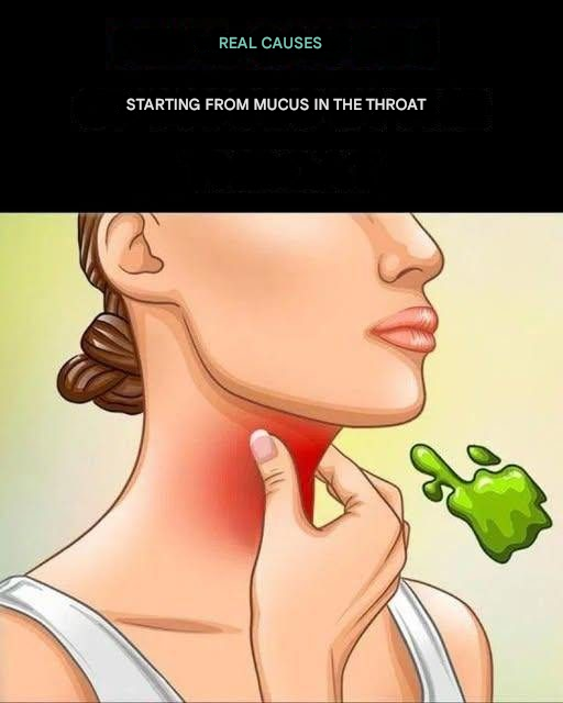 The real causes of mucus in the throat and how to get rid of it